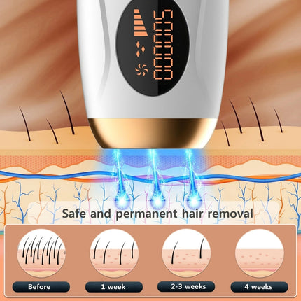 Deluxe IPL Hair Removal Device - 990K Flashes, 5 Power Levels