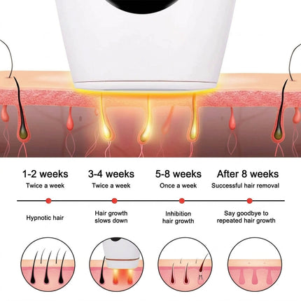 IPL Hair Removal Device - 990K Flashes, 5 Intensity Settings