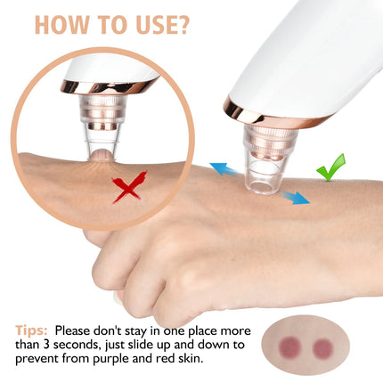 Blackhead Remover Pore Vacuum Cleaner - 5-Probe Suction Facial Cleaner