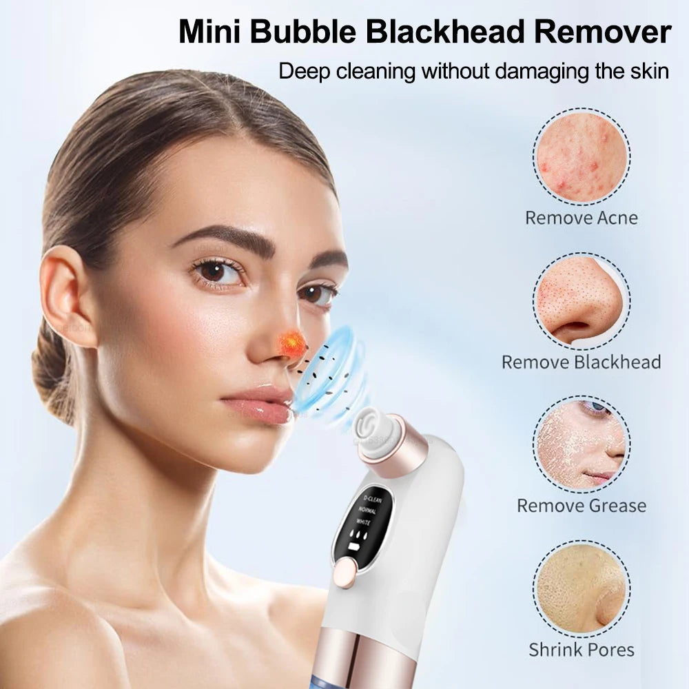 ManiRenew Deluxe Blackhead Remover Pore Vacuum Cleaner