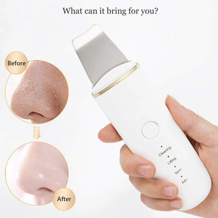 Ultrasonic Skin Scrubber & Pore Cleaner - 4-in-1 Facial Spatula