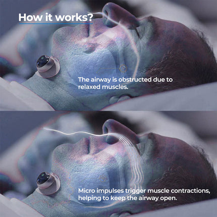 Anti-Snore Chin Clip - Soft, Adjustable, Non-Invasive Sleep Aid Support